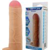 Navlaka za penis Bunion